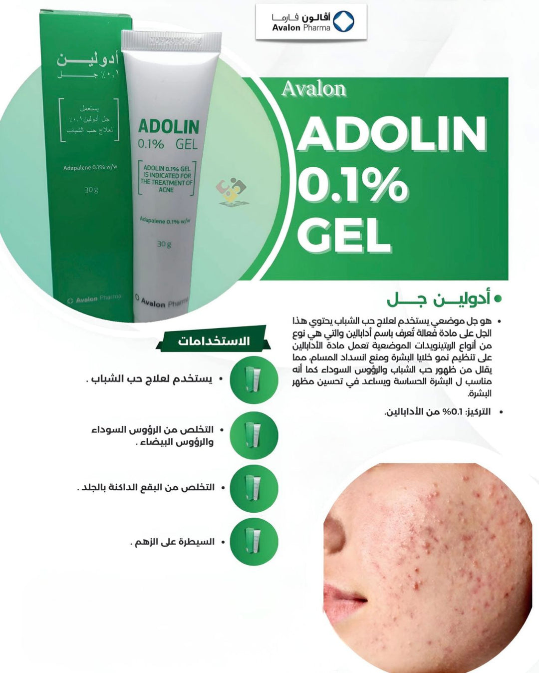 Avalon Pharma Adolin Gel 0.1% Is Indicated For The Treatment Of Acne - 30g | افالون فارما جل لعلاج حب الشباب أدابلين 0.1% - 30 غرام