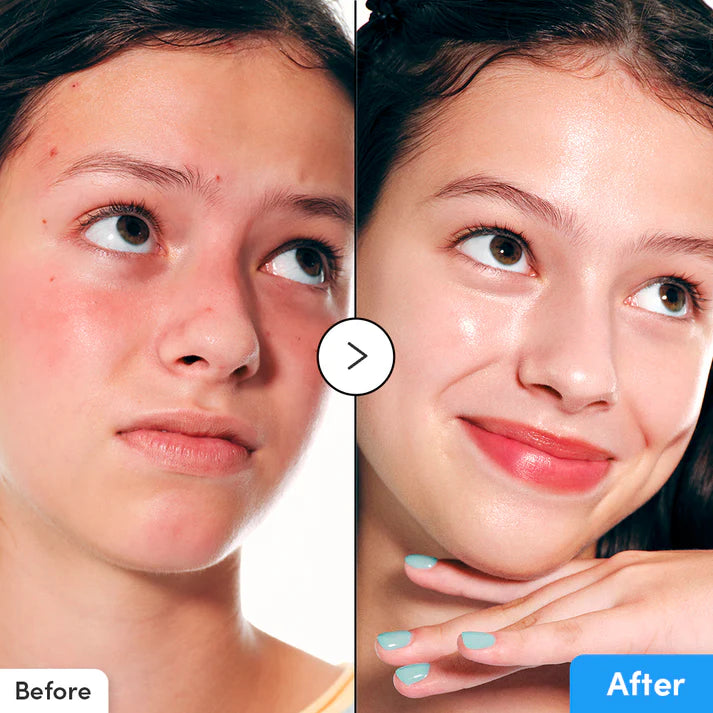 EQQUAL BERRY Blue Blow Hyaltoin Flooding Serum - 30ml | ايكوال بيري سيروم مرطب للوجه - 30 مل