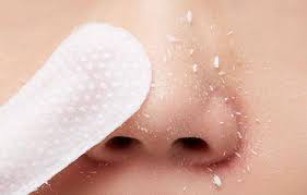 A`pieu Blackhead Peeling Pad - 5pcs | اپيو وسادة التقشير المزدوجة - 5 قطع