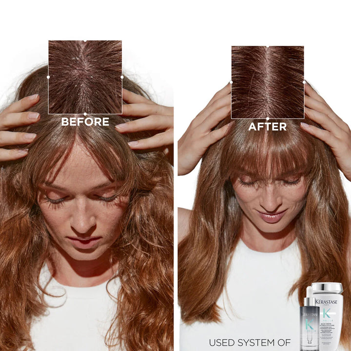 KÉRASTASE Symbiose Creme Hydrating Anti-Dandruff Shampoo - 250ml | كيراستاس شامبو مرطب ضد القشرة - 250 مل