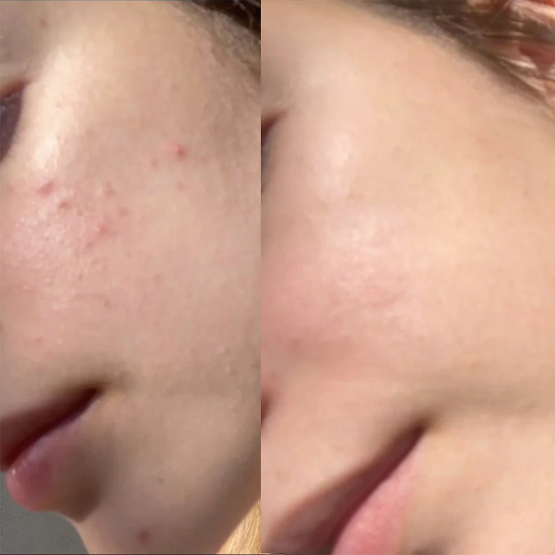 Perfect Image Lactic 10% Gel Peel - 30ml | بيرفكت إيمج مقشر حمض الاكتيك 10 % - 30 مل