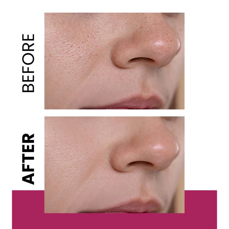 NEW WELL Skin Regenerating Anti-Spot Cream - 50ml | نيو ويل كريم لتجديد البشرة وإزالة البقع - 50 مل