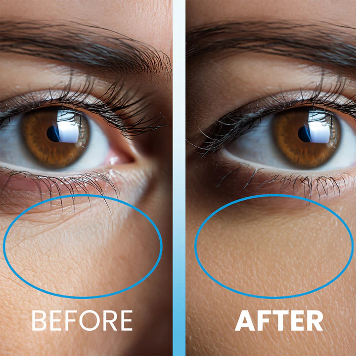 NEW WELL Ice Therapy Anti – Wrinkle Shock Eye Serum - 10ml | نيو ويل سيروم مبرد لمحيط العين - 10 مل