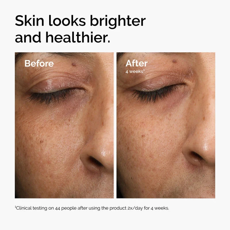 The Ordinary Multi-Antioxidant Radiance Serum rozjasňujúce sérum -30 ml| ذا أورديناري سيروم مضاد اكسدة ومضيء للبشرة -30مل