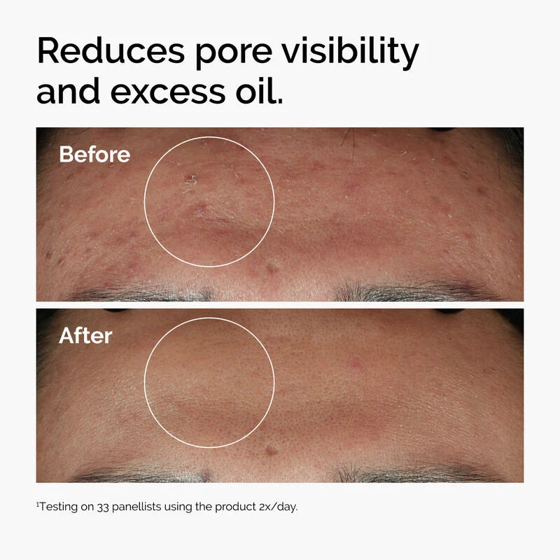 The Ordinary Niacinamide 10% + Zinc 1% - 30ml | ذا اورديناري سيروم نياسيناميد 10% + زنك 1% - 30 مل