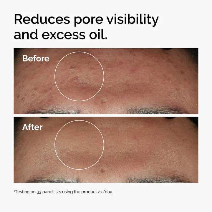The Ordinary Niacinamide 10% + Zinc 1% - 30ml | ذا اورديناري سيروم نياسيناميد 10% + زنك 1% - 30 مل