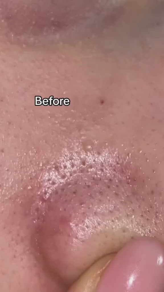 Medicube ZERO PORE PAD 2.0 - 70pcs | ميدي كيوب وسائد تونر - ٧٠ قطعة