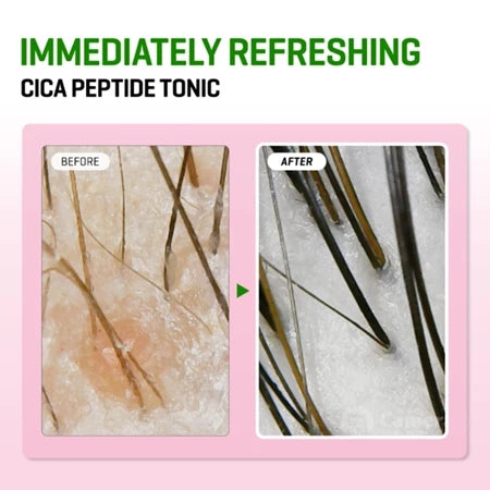 SOME BY MI Cica Peptide Anti Hair Loss Derma Scalp - 150ML | سوم باي مي تونر للشعر ضد تساقد الشعر - 150 مل