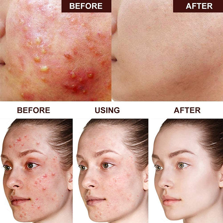 Cetaphil Gentle Skin Cleanser for Dry to Normal Sensitive Skin  |  سيتافيل غسول لطيف للبشرة الحساسة الجافة إلى العادية