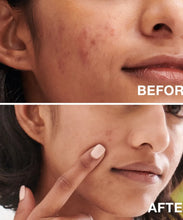جاري تحميل الصورة , Oil-Free Acne Fighting Face Wash - 269ml
