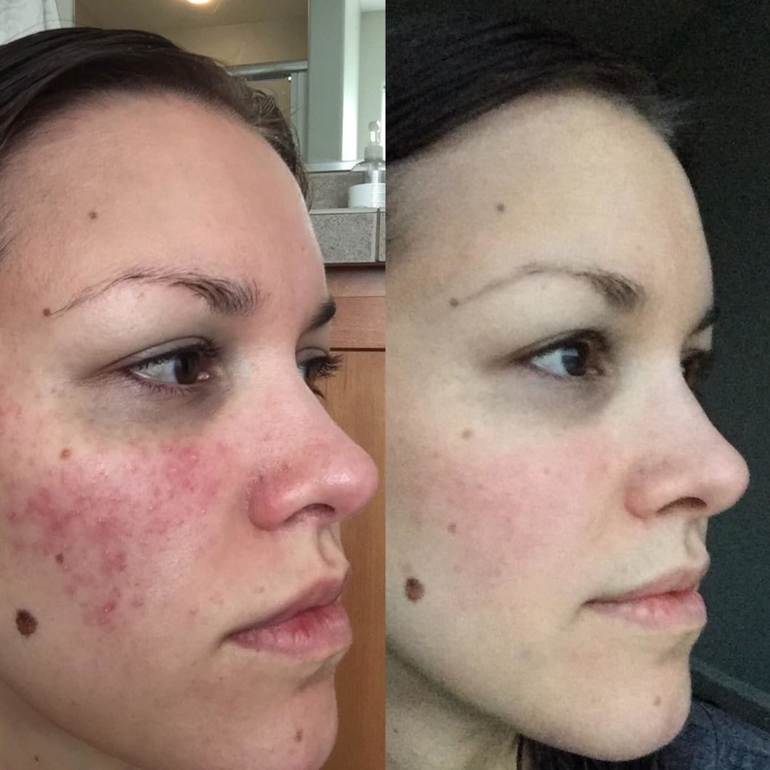 Cerave Daily Moisturizing Face & Body Lotion for Normal to Dry Skin | سيرافي مرطب للبشرة العادي و الجافة