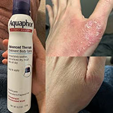 جاري تحميل الصورة , Aquaphor Body Ointment Spray - 250ml | بخاخ مرهم للجسم أكوافور - 250 مل
