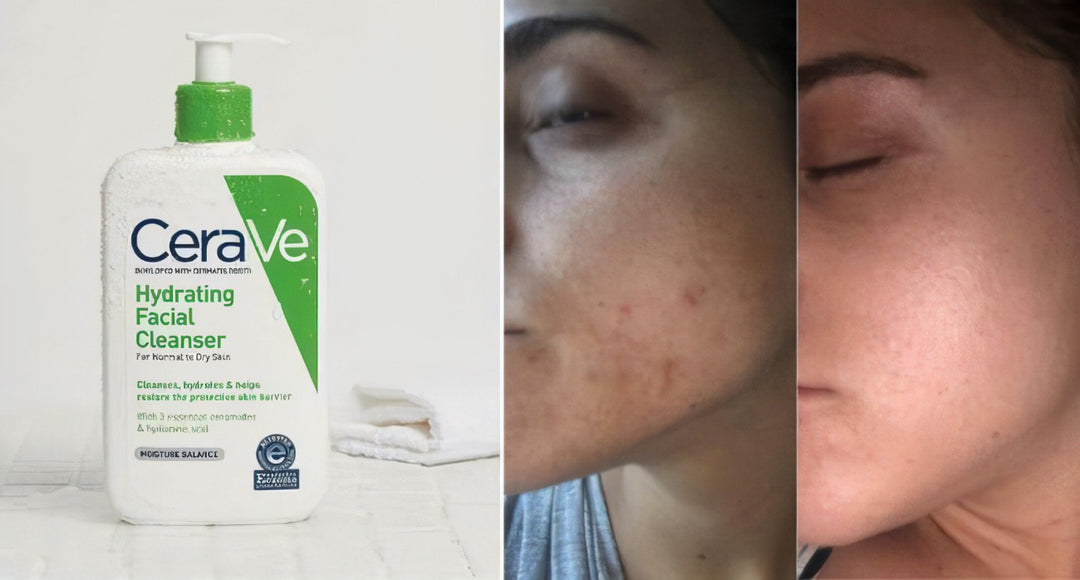 Cerave hydrating Face Wash Cleanser For Dry Skin  | سيرافي غسول للوجه يناسب البشرة الجافة