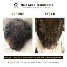 Oway Hair Loss Micro Stimulating Hair Bath - 240ml |او واي شامبو لتساقط الشعر - 240 مل